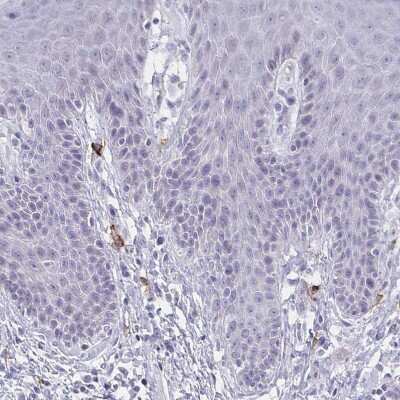 Immunohistochemistry-Paraffin: Fc epsilon RI beta/MS4A2 Antibody [NBP2-31807]