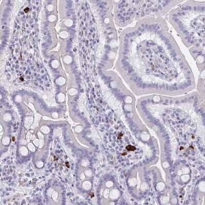 Immunohistochemistry-Paraffin: Fc epsilon RI beta/MS4A2 Antibody [NBP2-31807]