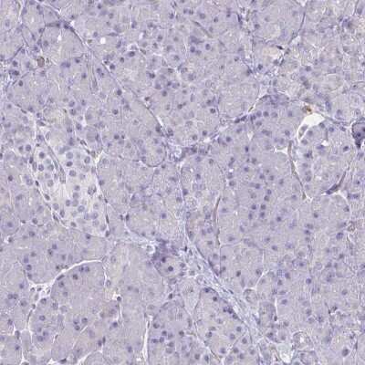 Immunohistochemistry-Paraffin: Fc epsilon RI beta/MS4A2 Antibody [NBP2-31807]