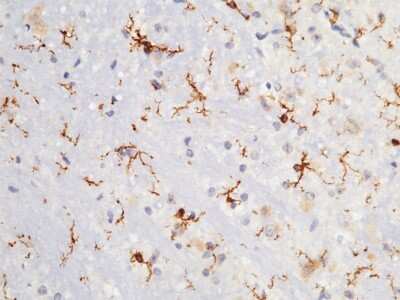 Immunohistochemistry-Paraffin: Fc gamma RI/CD64 Antibody (008) [NBP2-90404]