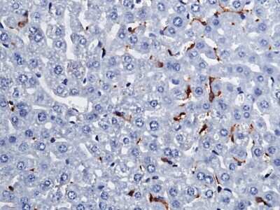 Immunohistochemistry-Paraffin: Fc gamma RI/CD64 Antibody (008) [NBP2-90404]