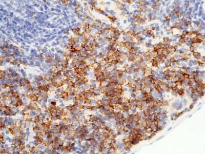 Immunohistochemistry-Paraffin: Fc gamma RI/CD64 Antibody (008) [NBP2-90404]