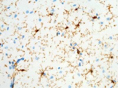 Immunohistochemistry-Paraffin: Fc gamma RI/CD64 Antibody (1) [NBP2-90403]