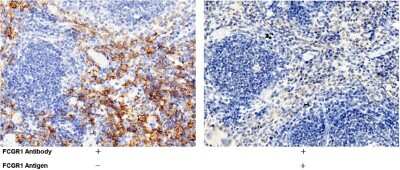 Immunohistochemistry-Paraffin: Fc gamma RI/CD64 Antibody (1) [NBP2-90403]