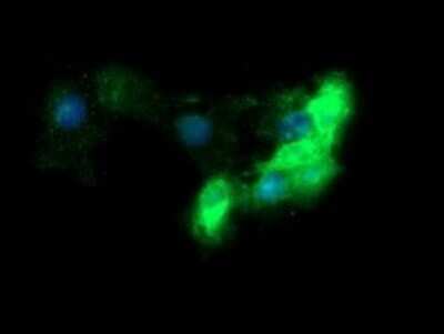 Immunocytochemistry/ Immunofluorescence: Fc gamma RI/CD64 Antibody (OTI1A8) - Azide and BSA Free [NBP2-70702]