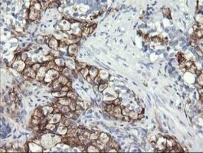 Immunohistochemistry: Fc gamma RI/CD64 Antibody (OTI1A8) - Azide and BSA Free [NBP2-70702]