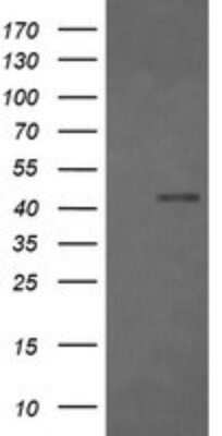 Western Blot: Fc gamma RI/CD64 Antibody (OTI1A8)Azide and BSA Free [NBP2-70702]