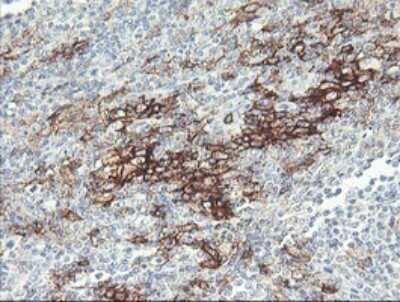 Immunohistochemistry: Fc gamma RI/CD64 Antibody (OTI1A8) [NBP2-45625]