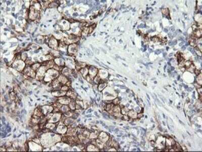 Immunohistochemistry: Fc gamma RI/CD64 Antibody (OTI1A8) [NBP2-45625]