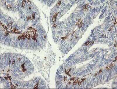 Immunohistochemistry: Fc gamma RI/CD64 Antibody (OTI1A8) [NBP2-45625]