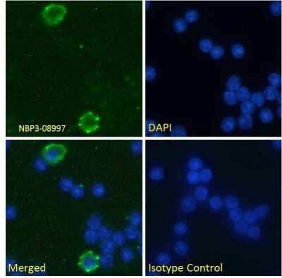 Immunocytochemistry/ Immunofluorescence: Fc gamma RII/CD32 Antibody (AT130-5) - Chimeric - Azide and BSA Free [NBP3-08997]