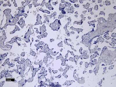 Immunohistochemistry-Paraffin: Fc gamma RII/CD32 Antibody [NB100-1532]