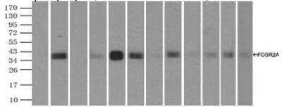 Immunoprecipitation: Fc gamma RIIA/CD32a Antibody (OTI9G5) [NBP1-47735]