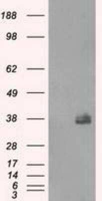 Western Blot: Fc gamma RIIA/CD32a Antibody (OTI9G5) [NBP1-47735]