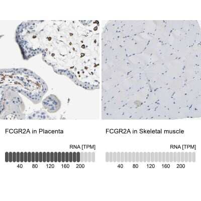 Immunohistochemistry-Paraffin: Fc gamma RIIA/CD32a Antibody [NBP1-84589]