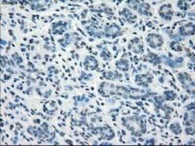 Immunohistochemistry: Fc gamma RIIA/CD32a Antibody (OTI9G5) - Azide and BSA Free [NBP2-70709]
