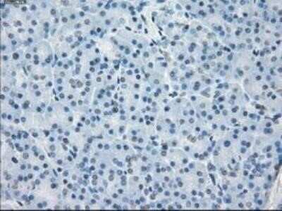 Immunohistochemistry: Fc gamma RIIA/CD32a Antibody (OTI9G5) - Azide and BSA Free [NBP2-70709]