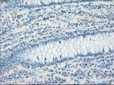 Immunohistochemistry: Fc gamma RIIA/CD32a Antibody (OTI9G5) - Azide and BSA Free [NBP2-70709]
