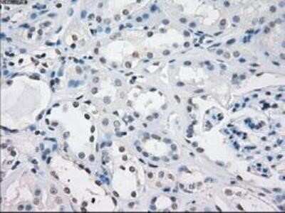Immunohistochemistry: Fc gamma RIIA/CD32a Antibody (OTI9G5) - Azide and BSA Free [NBP2-70709]