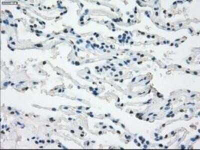 Immunohistochemistry: Fc gamma RIIA/CD32a Antibody (OTI9G5) - Azide and BSA Free [NBP2-70709]