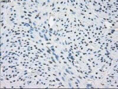 Immunohistochemistry: Fc gamma RIIA/CD32a Antibody (OTI9G5) - Azide and BSA Free [NBP2-70709]