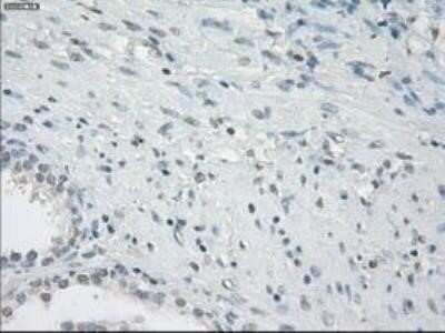 Immunohistochemistry: Fc gamma RIIA/CD32a Antibody (OTI9G5) - Azide and BSA Free [NBP2-70709]
