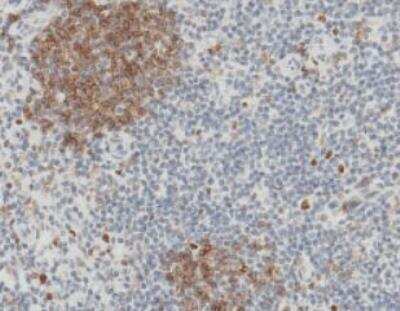 Immunohistochemistry-Paraffin: Fc gamma RIIB/CD32b Antibody (110) [NBP2-89364]
