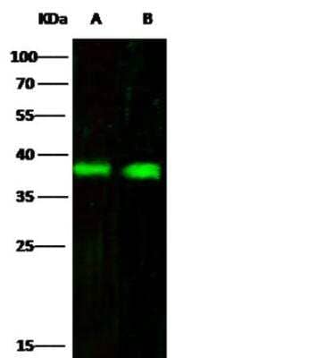 Western Blot: Fc gamma RIIB/CD32b Antibody (110) [NBP2-89364]