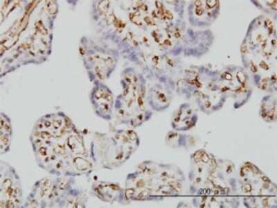 Immunohistochemistry-Paraffin: Fc gamma RIIB/CD32b Antibody (2E10) [H00002213-M01]