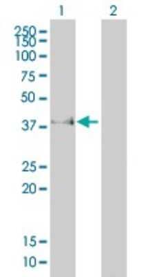 Western Blot: Fc gamma RIIB/CD32b Antibody (2E10) [H00002213-M01]