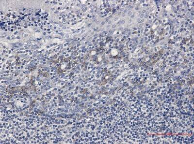 Immunohistochemistry-Paraffin: Fc gamma RIIB/CD32b Antibody (S07-4B5) [NBP3-19496]