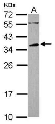 Western Blot: Fc gamma RIIB/CD32b Antibody [NBP2-14904]