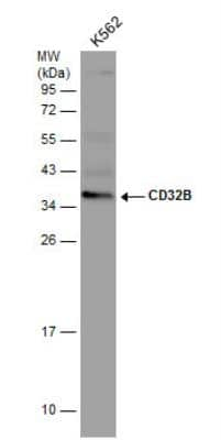 Western Blot: Fc gamma RIIB/CD32b Antibody [NBP2-14904]