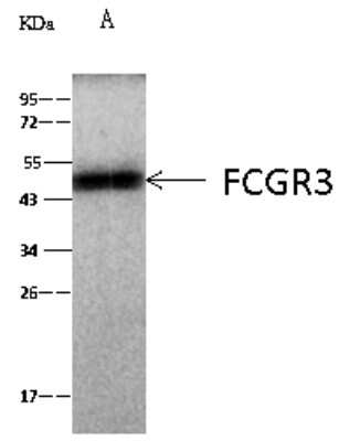 Immunoprecipitation: Fc gamma RIII (CD16) Antibody (015) [NBP2-90536]