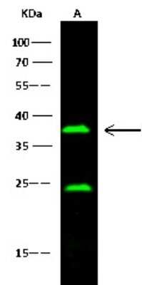 Western Blot: Fc gamma RIII (CD16) Antibody (015) [NBP2-90536]