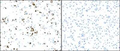 Immunohistochemistry: Fc gamma RIIIA/CD16a Antibody (BLR162J) [NBP3-14736]