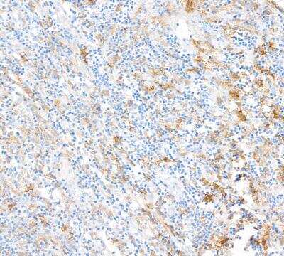 Immunohistochemistry: Fc gamma RIIIA/CD16a Antibody (BLR162J) [NBP3-14736]