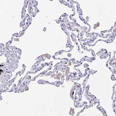 Immunohistochemistry-Paraffin: Fc gamma RIIIA/CD16a Antibody [NBP2-33753]