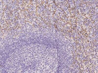 Immunohistochemistry-Paraffin: Fc gamma RIIIA/CD16a Antibody [NBP2-99278]