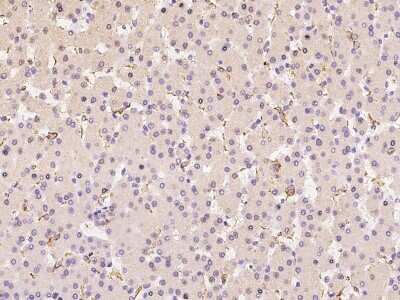 Immunohistochemistry-Paraffin: Fc gamma RIIIA/CD16a Antibody [NBP2-99278]