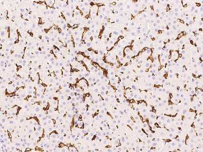 Immunohistochemistry-Paraffin: Fc gamma RIIIA/CD16a Antibody [NBP2-99278]