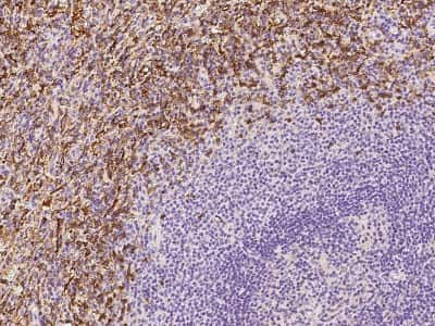 Immunohistochemistry-Paraffin: Fc gamma RIIIA/CD16a Antibody [NBP2-99278]