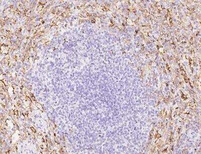 Immunohistochemistry-Paraffin: Fc gamma RIIIB/CD16b Antibody (24) [NBP3-12795]