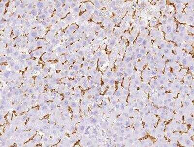 Immunohistochemistry-Paraffin: Fc gamma RIIIB/CD16b Antibody (24) [NBP3-12795]