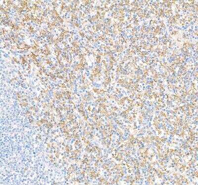 Immunohistochemistry: Fc gamma RIIIB/CD16b Antibody (BLR163J) [NBP3-14737]