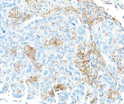Immunohistochemistry: Fc gamma RIIIB/CD16b Antibody (BLR163J) [NBP3-14737]