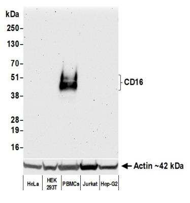 Western Blot: Fc gamma RIIIB/CD16b Antibody (BLR163J) [NBP3-14737]