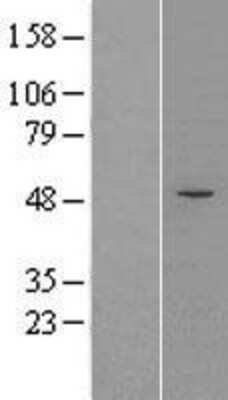 Western Blot: FCRLB/FCRY Overexpression Lysate [NBL1-10667]