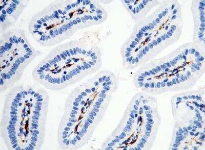 Immunohistochemistry-Paraffin: FcgR4/CD16-2 Antibody (011) [NBP3-05889]