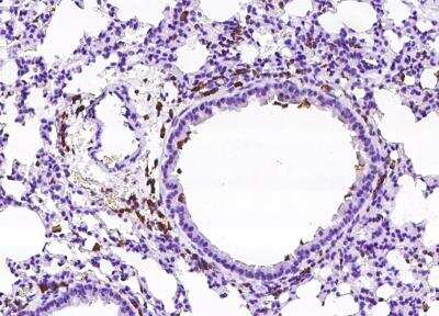 Immunohistochemistry-Paraffin: FcgR4/CD16-2 Antibody [NBP3-05901]